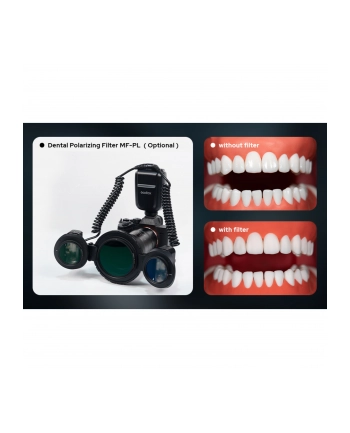 Godox MF-PL Dental Pol filtr do MF-T76